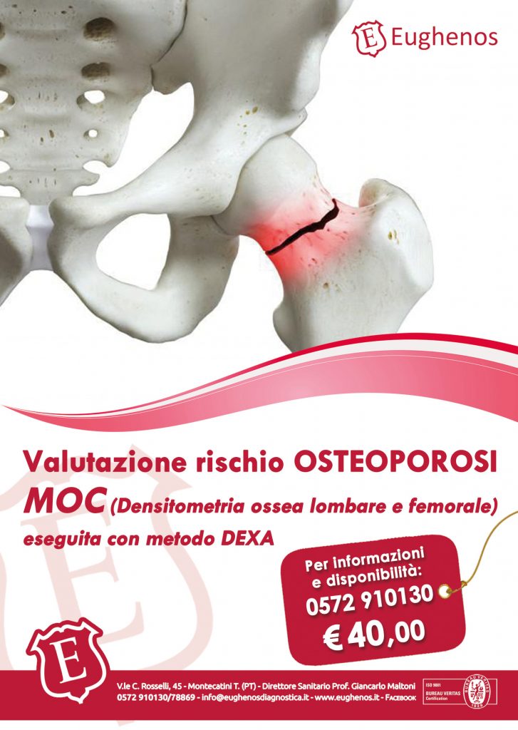 Prevenzione osteoporosi