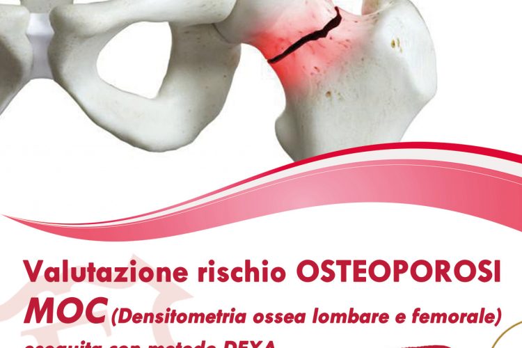 Prevenzione osteoporosi